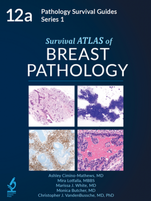 Survival ATLAS of Breast Pathology (Pathology Survival Guides Series 1 vol. 12a)