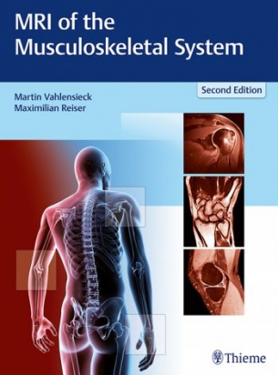 MRI of the Musculoskeletal System 2nd ed