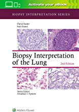 Biopsy Interpretation of the Lung Second edition