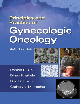 Principles and Practice of Gynecologic Oncology 8th edition