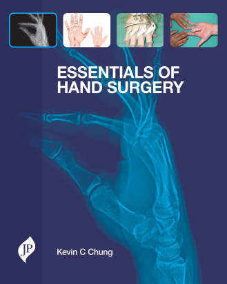 Essentials of Hand Surgery 