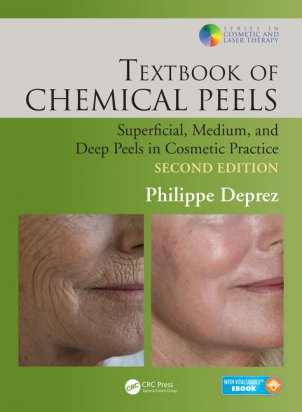 Textbook of Chemical Peels, Second Edition