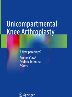 Unicompartmental Knee Arthroplasty