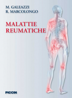 Malattie reumatiche