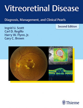 Vitreoretinal Disease