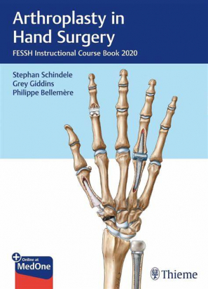 Arthroplasty in Hand Surgery