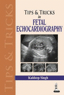 Tips &amp; Tricks in Fetal Echocardiography