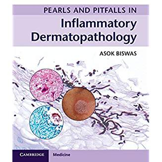 Pearls and Pitfalls in Inflammatory Dermatopathology