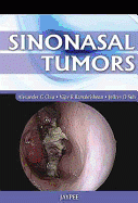 Sinonasal Tumors
