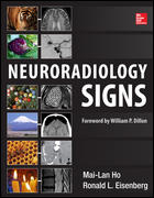 Neuroradiology Signs