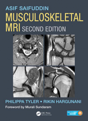 Musculoskeletal MRI, Second Edition