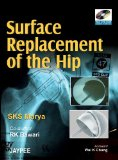 Surface Replacement of the Hip