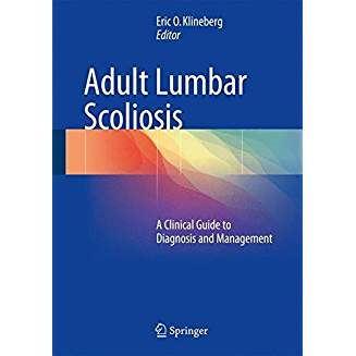 Adult Lumbar Scoliosis