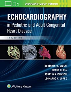 Echocardiography in Pediatric and Adult Congenital Heart Disease Third edition