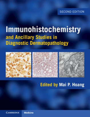 Immunohistochemistry and Ancillary Studies in Diagnostic Dermatopathology, 2nd Edition