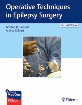 Operative Techniques in Epilepsy Surgery