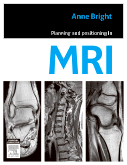 Planning and Positioning in MRI