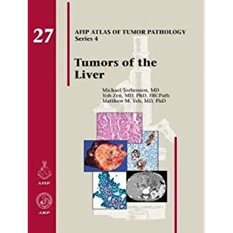 AFIP 4  Fasc. 27  Tumors of the Liver