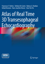 Atlas of Real Time 3D Transesophageal Echocardiography