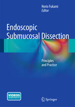 Endoscopic Submucosal Dissection