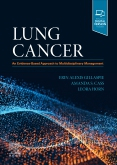 Lung Cancer - An Evidence-Based Approach to Multidisciplinary Management