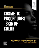 Procedures in Cosmetic Dermatology: Cosmetic Procedures in Skin of Color