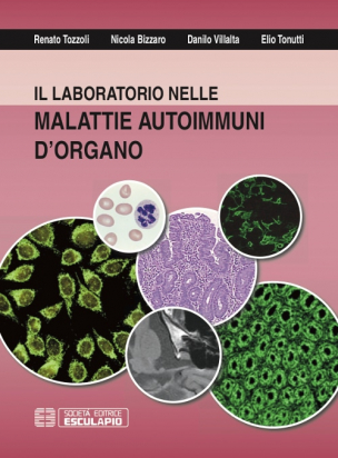 Il Laboratorio nelle malattie autoimmuni d’organo