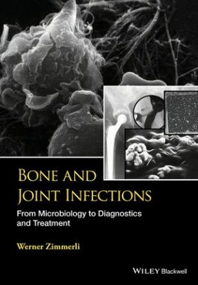 Bone and Joint Infections: From Microbiology to Diagnostics and Treatment