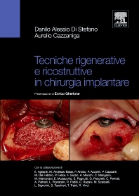 Tecniche rigenerative e ricostruttive in chirurgia implantare, 1st Edition