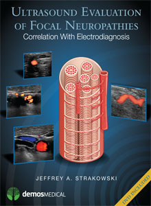 Ultrasound Evaluation of Focal Neuropathies Correlation with Electrodiagnosis