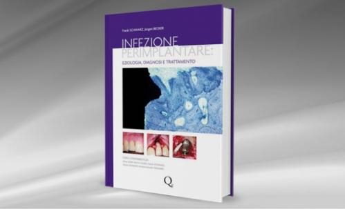 Infezione perimplantare: eziologia, diagnosi e trattamento