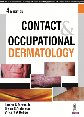 Contact &amp; Occupational Dermatology