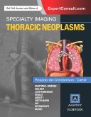 Specialty Imaging: Thoracic Neoplasms 