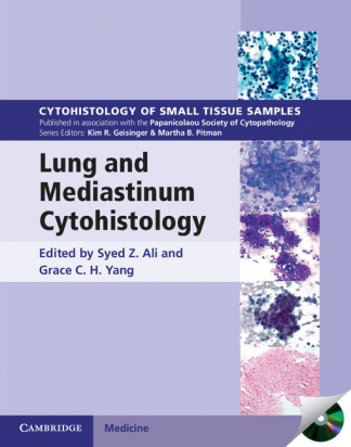 Lung and Mediastinum Cytohistology