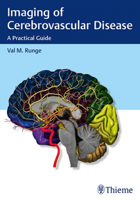 Imaging of Cerebrovascular Disease