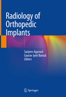 Radiology of Orthopedic Implants