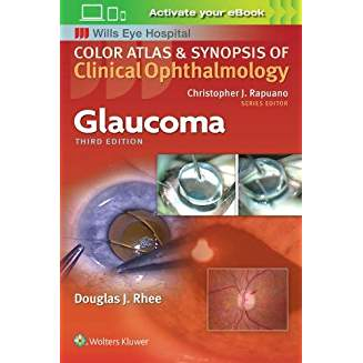 Glaucoma 3rd edition