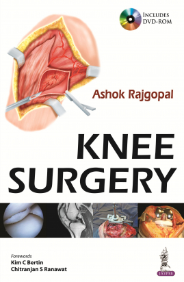 Knee Surgery