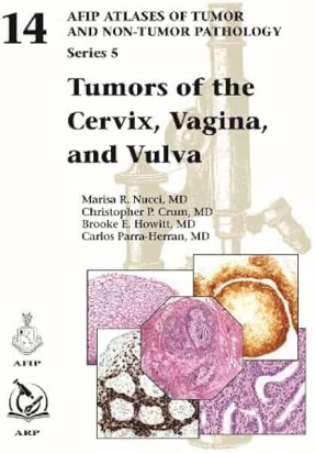 AFIP series 5 Fasc. 14  Tumors of the Cervix, Vagina, and Vulva