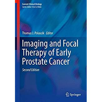 Imaging and Focal Therapy of Early Prostate Cancer