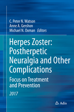 Herpes Zoster: Postherpetic Neuralgia and Other Complications