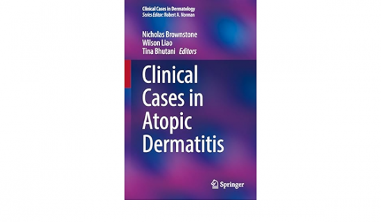 Clinical Cases in Atopic Dermatitis