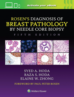 Rosen's Diagnosis of Breast Pathology by Needle Core Biopsy 5th edition