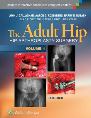 The Adult Hip (Two Volume Set), 3e 