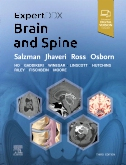 ExpertDDx: Brain and Spine, 3rd Edition