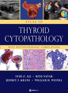 Atlas of Thyroid Cytopathology - With Histopathologic Correlations