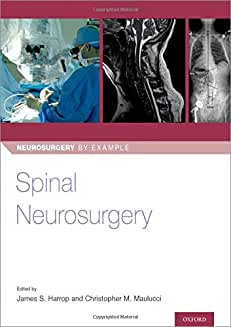 Spinal Neurosurgery