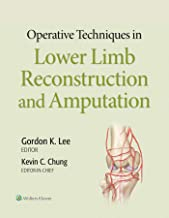 Operative Techniques in Lower Limb Reconstruction and Amputation