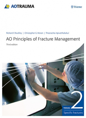 AO Principles of Fracture Management 3rd ed