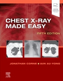 Chest X-Ray Made Easy, 5th Edition